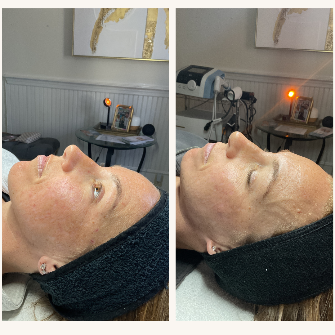 Before and After Glow Up